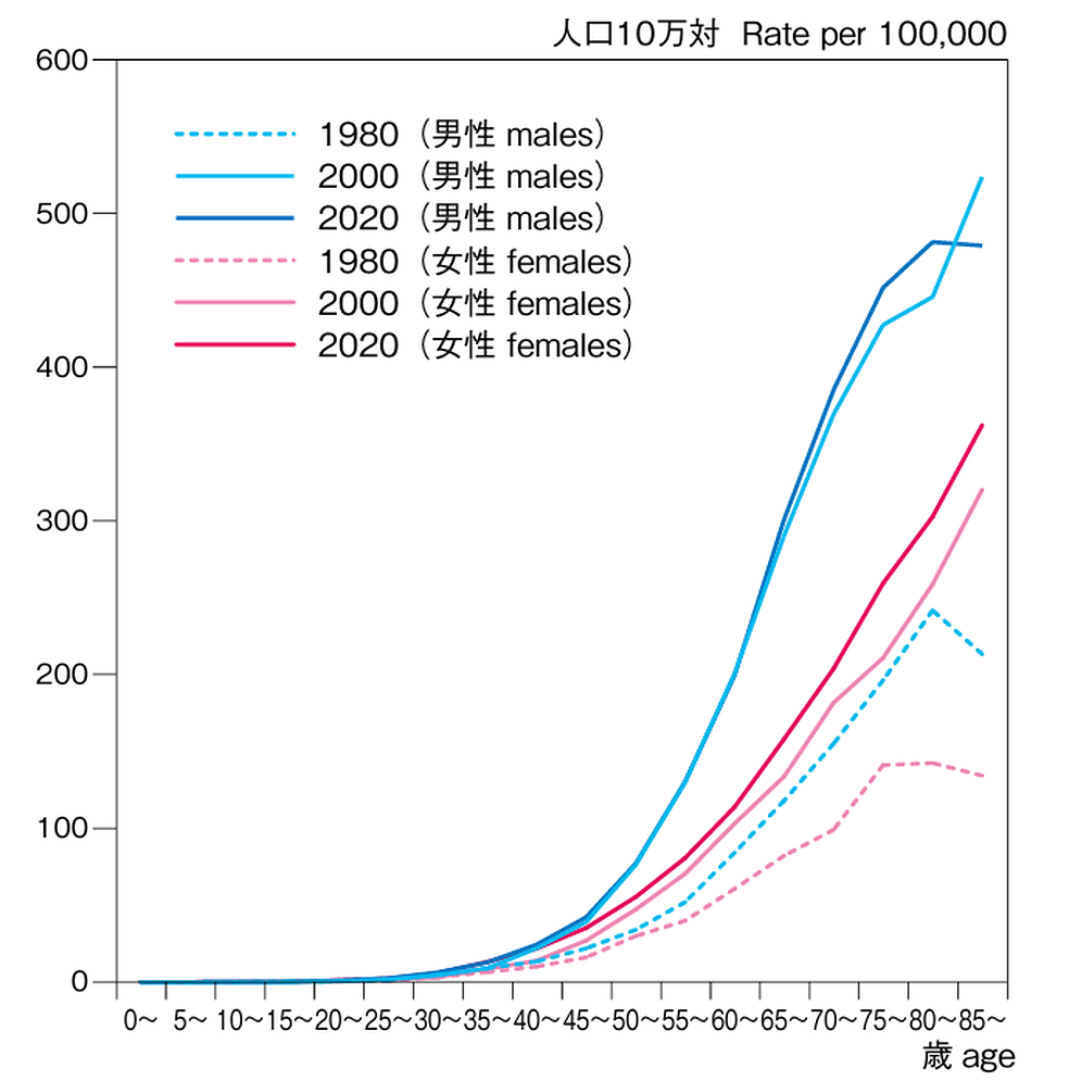 年齢階級別がん罹患率推移（1980年、2000年、2020年）